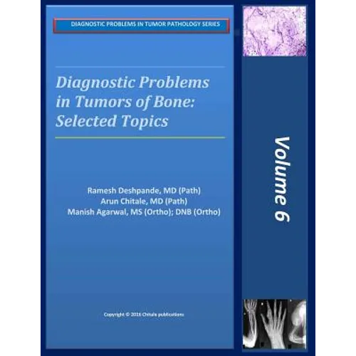 Diagnostic Problems in Bone Tumors: Selected Topics - Paperback