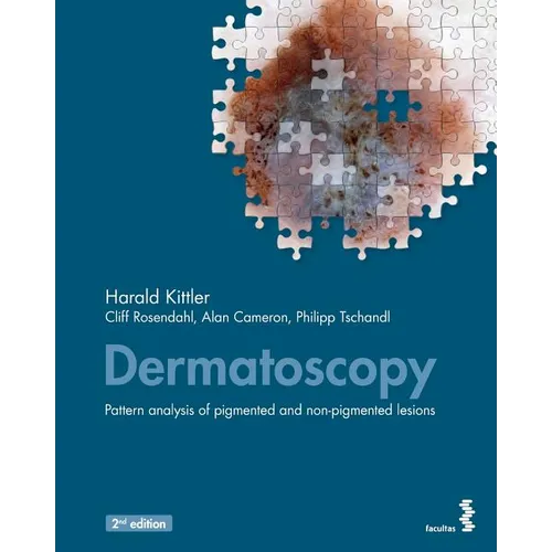 Dermatoscopy: Pattern analysis of pigmented and non-pigmented lesions - Paperback
