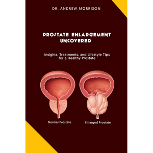 Prostrate Enlargement Uncovered: Insights, Treatments, and Lifestyle Tips for a Healthy Prostate - Paperback