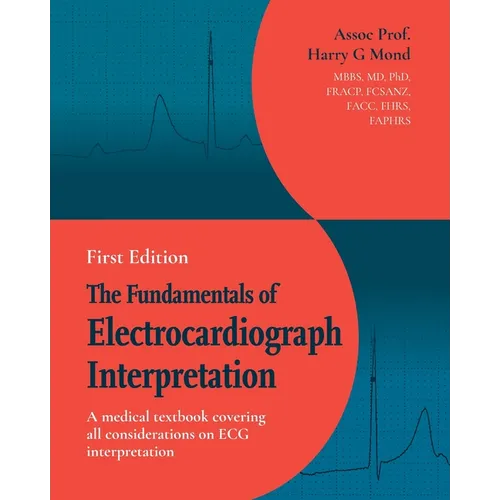 The Fundamentals of Electrocardiograph Interpretation: A medical textbook covering all considerations on ECG interpretation - Paperback