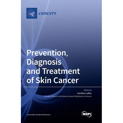 Prevention, Diagnosis and Treatment of Skin Cancer - Hardcover