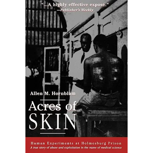 Acres of Skin: Human Experiments at Holmesburg Prison - Paperback