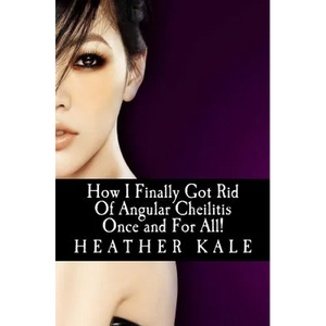 How I Finally Got Rid Of Angular Cheilitis Once and For All!: Cracked Mouth Corners No More - Paperback