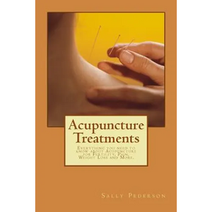 Acupuncture Treatments: Everything You Need to Know about Acupuncture for Fertility, Pain, Weight Loss and More. - Paperback