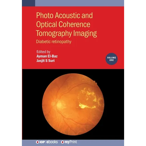 Photo Acoustic and Optical Coherence Tomography Imaging, Volume 1: Diabetic retinopathy - Paperback