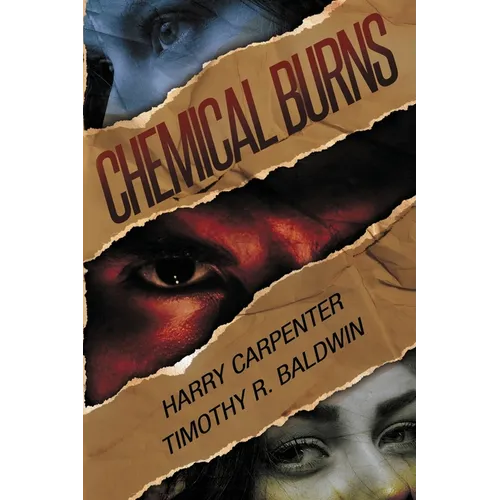 Chemical Burns - Paperback