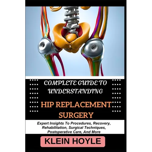 Complete Guide to Understanding Hip Replacement Surgery: Expert Insights To Procedures, Recovery, Rehabilitation, Surgical Techniques, Postoperative C - Paperback