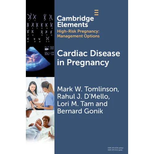 Cardiac Disease in Pregnancy - Paperback