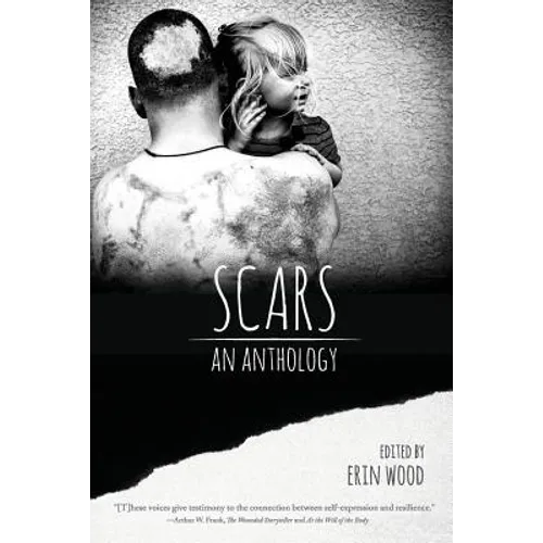 Scars: An Anthology - Paperback