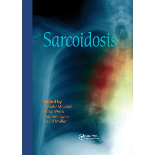 Sarcoidosis - Paperback