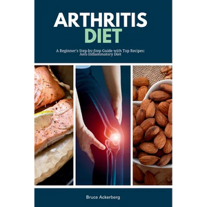 Arthritis Diet: A Beginner's Step-by-Step Guide with Top Recipes: Anti-Inflammatory Diet - Paperback