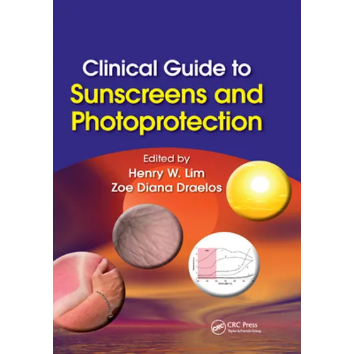 Clinical Guide to Sunscreens and Photoprotection - Paperback