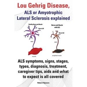 Lou Gehrig Disease, ALS or Amyotrophic Lateral Sclerosis Explained. ALS Symptoms, Signs, Stages, Types, Diagnosis, Treatment, Caregiver Tips, AIDS and - Paperback
