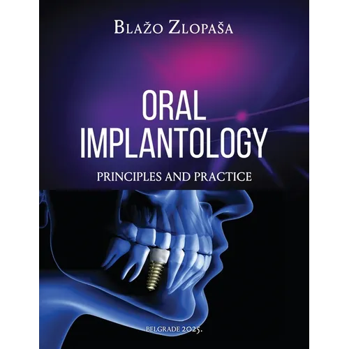 Oral Implantology: Principles and Practice - Paperback