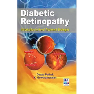 Diabetic Retinopathy: Introduction to Novel Treatment Strategies - Hardcover