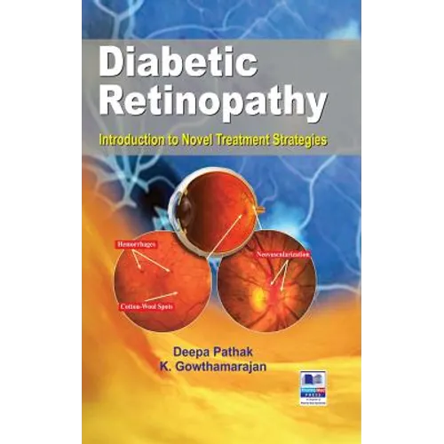 Diabetic Retinopathy: Introduction to Novel Treatment Strategies - Hardcover