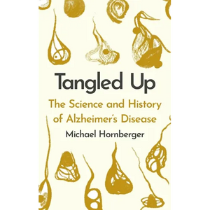 Tangled Up: The History and Science of Alzheimer's Disease - Hardcover