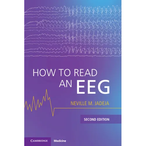How to Read an Eeg - Paperback