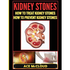 Kidney Stones: How To Treat Kidney Stones: How To Prevent Kidney Stones - Hardcover