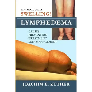 It's Not Just a Swelling! Lymphedema: Causes, Prevention, Treatment, Self-Management - Paperback