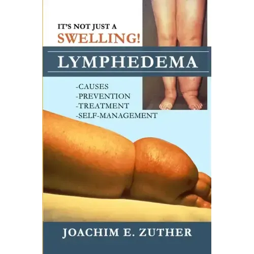 It's Not Just a Swelling! Lymphedema: Causes, Prevention, Treatment, Self-Management - Paperback