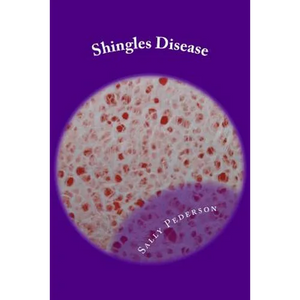 Shingles Disease: The Complete Guide - Paperback