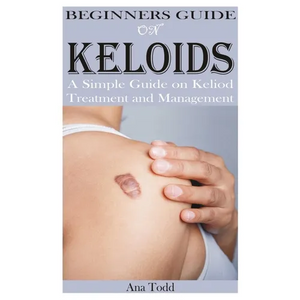 Beginners Guide on Keloids - Paperback