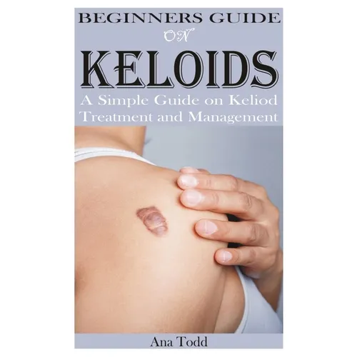 Beginners Guide on Keloids - Paperback