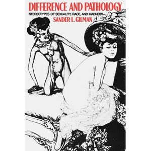 Difference and Pathology: Shakespeare's English Chronicles - Paperback