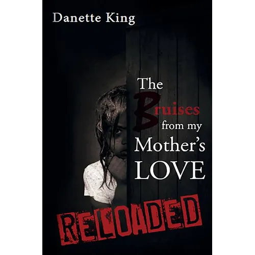 The Bruises from my Mother's Love - Paperback
