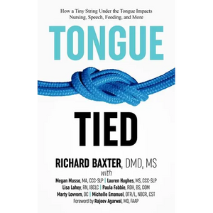 Tongue-Tied: How a Tiny String Under the Tongue Impacts Nursing, Speech, Feeding, and More - Paperback