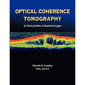 Optical Coherence Tomography a Clinical Atlas of Retinal Images - Paperback