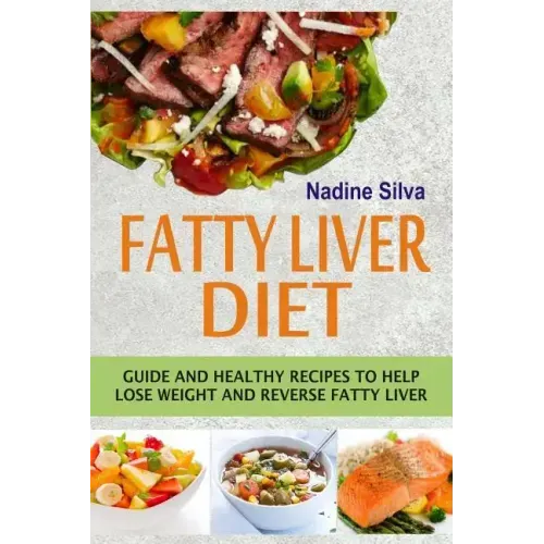 Fatty Liver Diet: Guide And Healthy Recipes To Help Lose Weight And Reverse Fatty Liver - Paperback