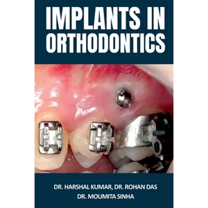 Implants in Orthodontics - Paperback