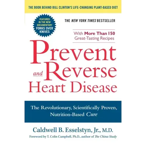 Prevent and Reverse Heart Disease: The Revolutionary, Scientifically Proven, Nutrition-Based Cure - Paperback
