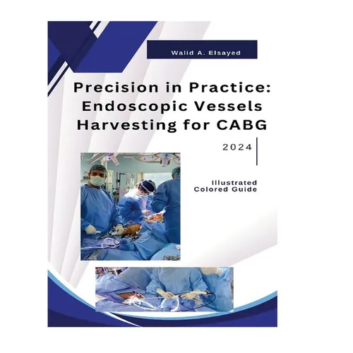 Precision in Practice: Endoscopic Vessel Harvesting for CABG - Hardcover