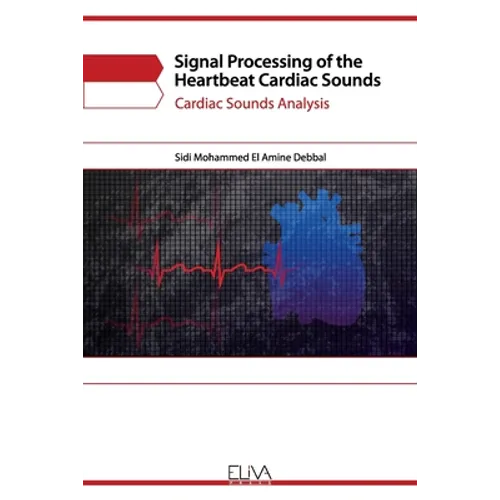 Signal Processing of the Heartbeat Cardiac Sounds: Cardiac Sounds Analysis - Paperback