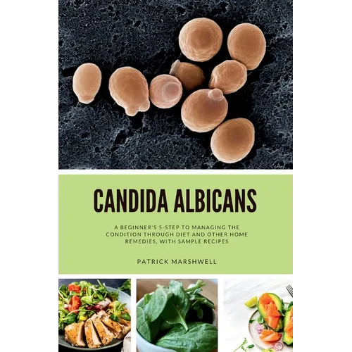 Candida Albicans: A Beginner's 5-Step to Managing the Condition Through Diet and Other Home Remedies, With Sample Recipes - Paperback