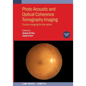Photo Acoustic and Optical Coherence Tomography Imaging, Volume 2: Fundus imaging for the retina - Paperback