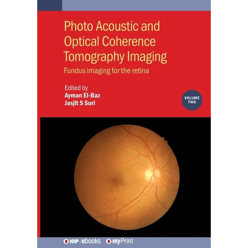 Photo Acoustic and Optical Coherence Tomography Imaging, Volume 2: Fundus imaging for the retina - Paperback