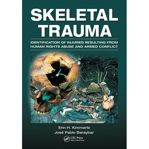 Skeletal Trauma: Identification of Injuries Resulting from Human Rights Abuse and Armed Conflict - Paperback
