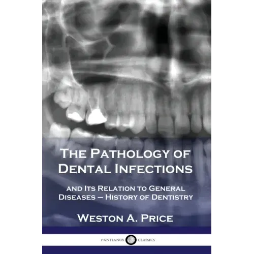 The Pathology of Dental Infections: and Its Relation to General Diseases - History of Dentistry - Paperback