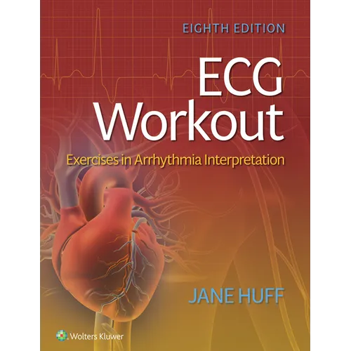 ECG Workout: Exercises in Arrhythmia Interpretation - Paperback