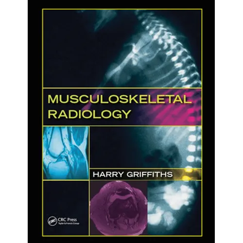 Musculoskeletal Radiology - Paperback