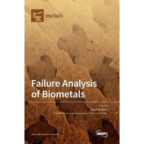 Failure Analysis of Biometals - Hardcover