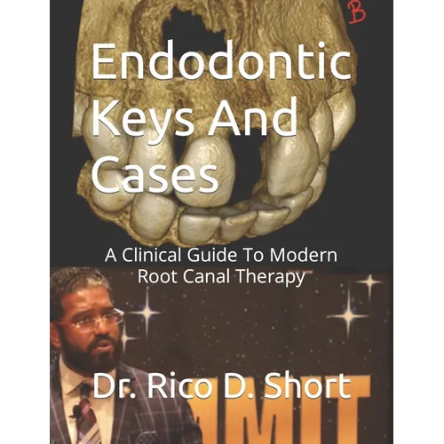 Endodontic Keys And Cases: A Clinical Guide To Modern Root Canal Therapy - Paperback