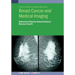 Breast Cancer and Medical Imaging - Paperback