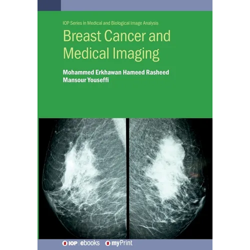 Breast Cancer and Medical Imaging - Paperback