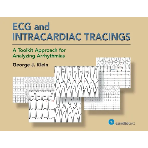 ECG and Intracardiac Tracings: A Toolkit Approach for Analyzing Arrhythmias - Paperback