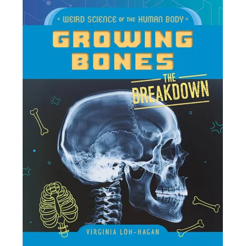 Growing Bones - Library Binding